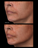 Peptide Facial Refining Concentrate