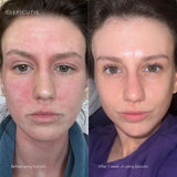 Luxury Skincare Set