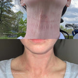 Post Procedure Set
