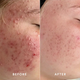 Lipid Serum