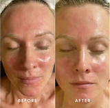 Lipid Serum
